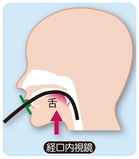 経口内視鏡